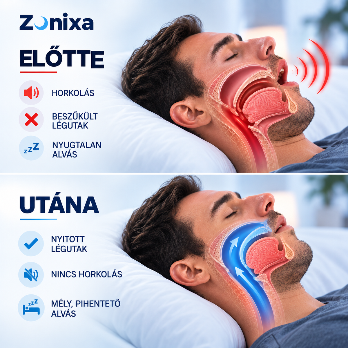 Zonixa