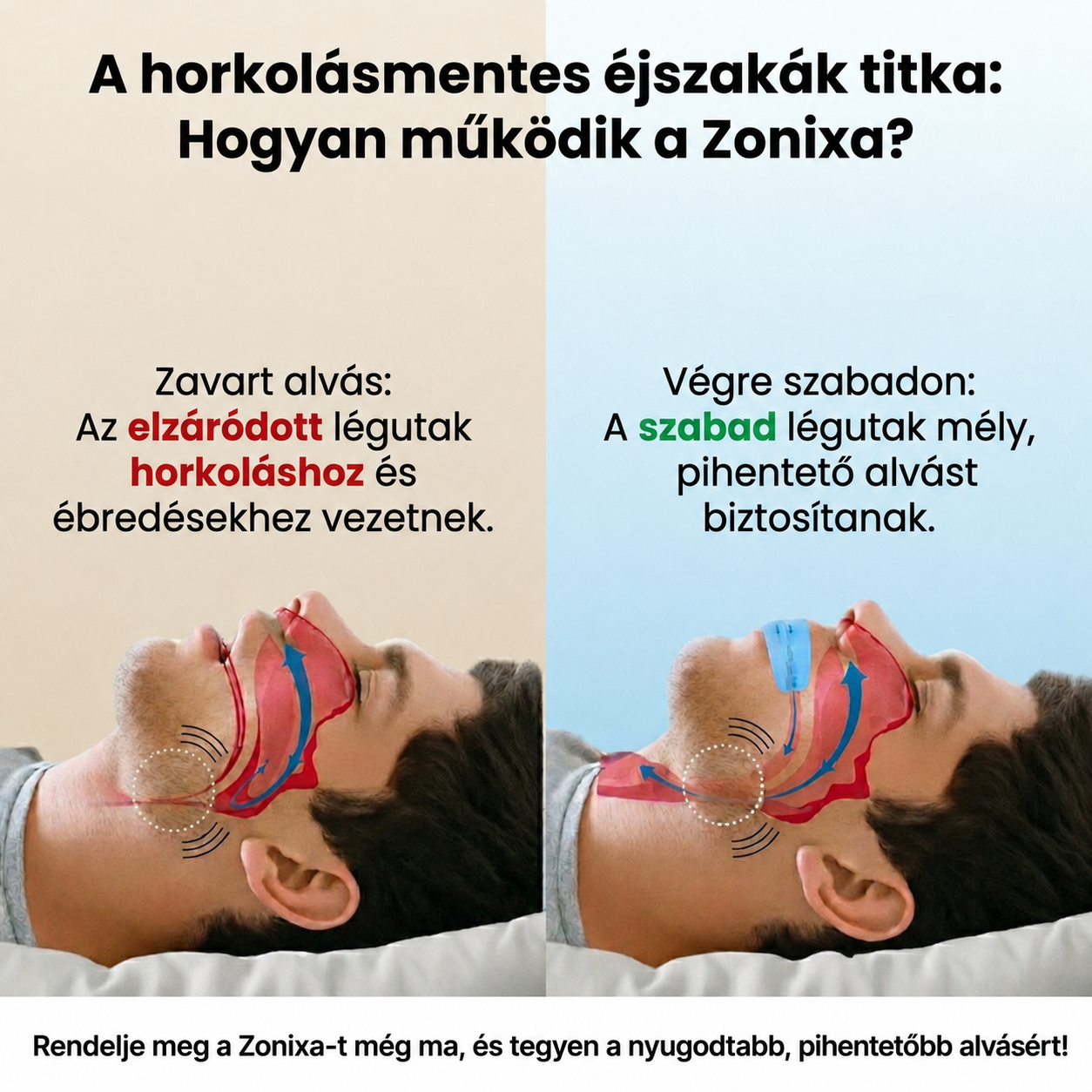 Zonixa